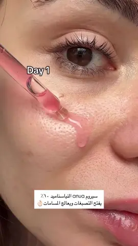 متوفر في ايهرب ويس ستايل واستفيدو من اكواد الخصم💕🌱 ايهرب BDS5441 يس ستايل NAMA15A #anua #yesstyle #iherb #anuaniacinamideserum #kbeauty #pores #skincare 