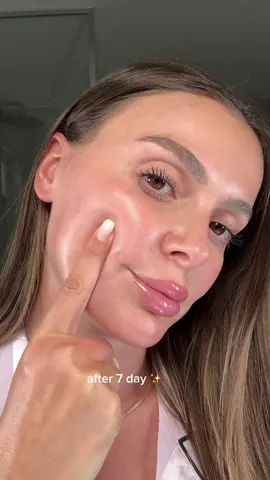 Give me 7 day >>>  @anua_global  #skin #skincare #skincaretips #kbeauty #skincareviral #skincareroutine #kbeautyskincare 