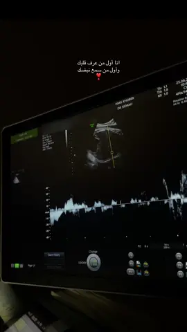 حبيبة قلب الماما 🥹❣️  #explore #حمل #سونار #fyppppppppppppppppppp 