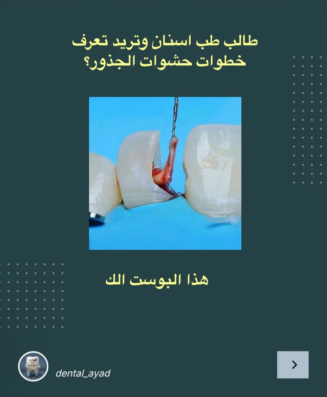 #طب_اسنان #طبيب_اسنان #dental 