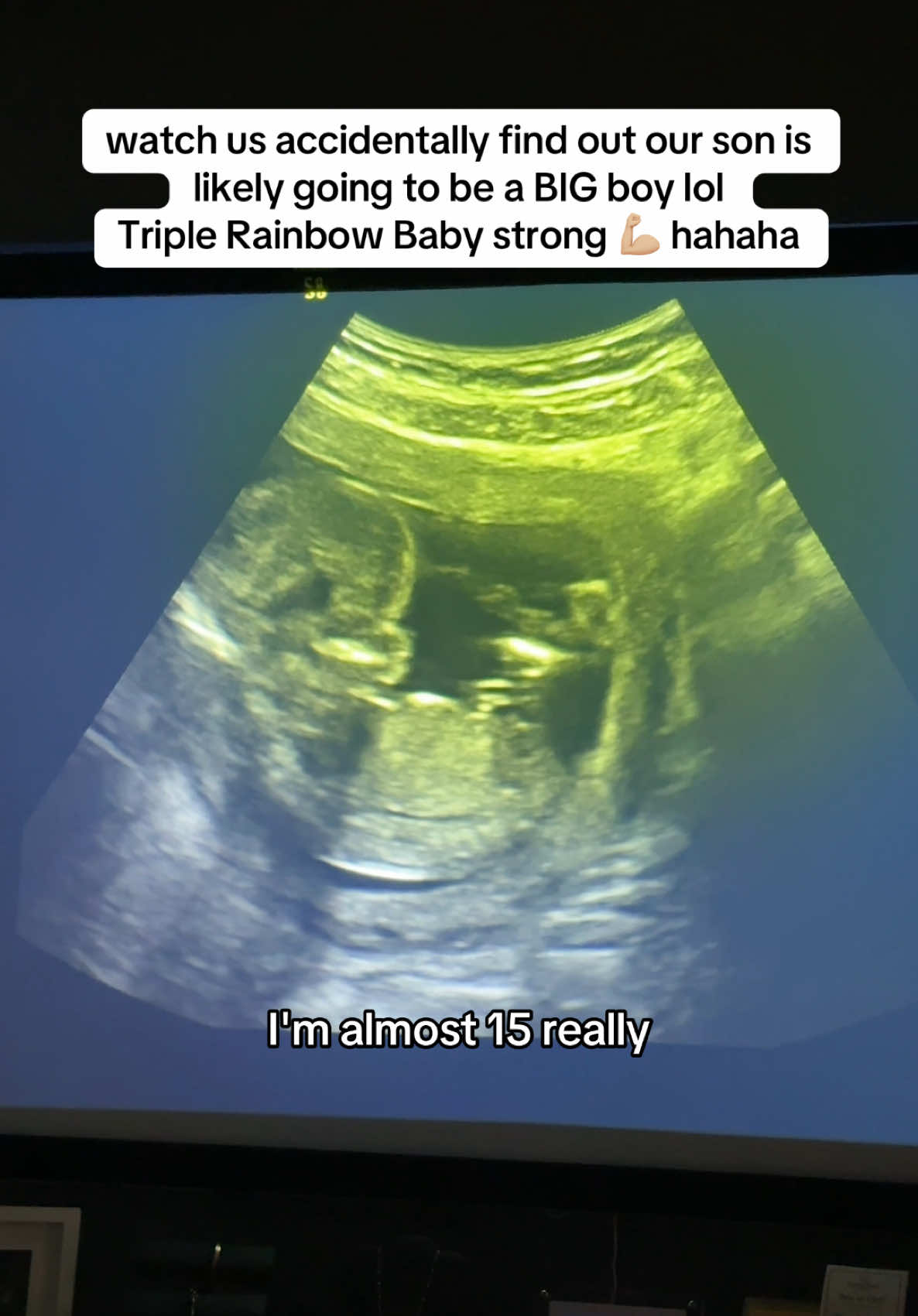 We were CRACKING UP 😭 I was 14w4d, but I guess when I booked our private ultrasound, I accidentally put in Dec 20 instead of Dec 30 (his actual due date)… which bumped him to 16 weeks in their system. We kept scanning and the tech was like, “He looks great for 16 weeks!” and we were like uhhh?? I’m 14w4d! 😂 (And yes, I know his exact gestational age lol.) She was so convinced by what she was seeing, she even had me pull up an app to prove it 😅 I was like girrrl I swear!! He’s just looking real good haha. Which, of course, is a huge relief. My OB mentioned Lovenox babies can sometimes run a little small… NOT OUR GUY 😅😅 She did say the 20-week scan will tell us more — but based on what I’ve seen and felt so far… I tend to agree. He’s on a big trajectory 🫶🏽🥲💙