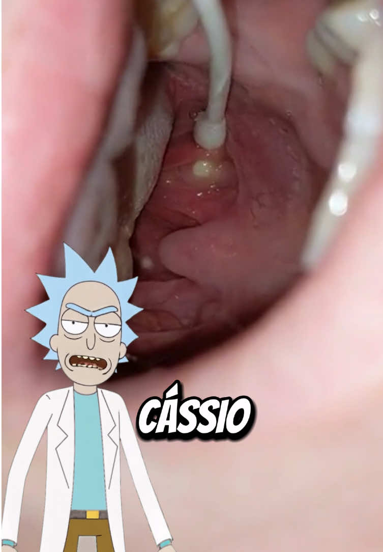 Não quer ficar com bafinho de 💩? Então veja isso! 🚨 . . #saude #dentes #dentista #clareamentodental #alito #bafo #tiktokshop 