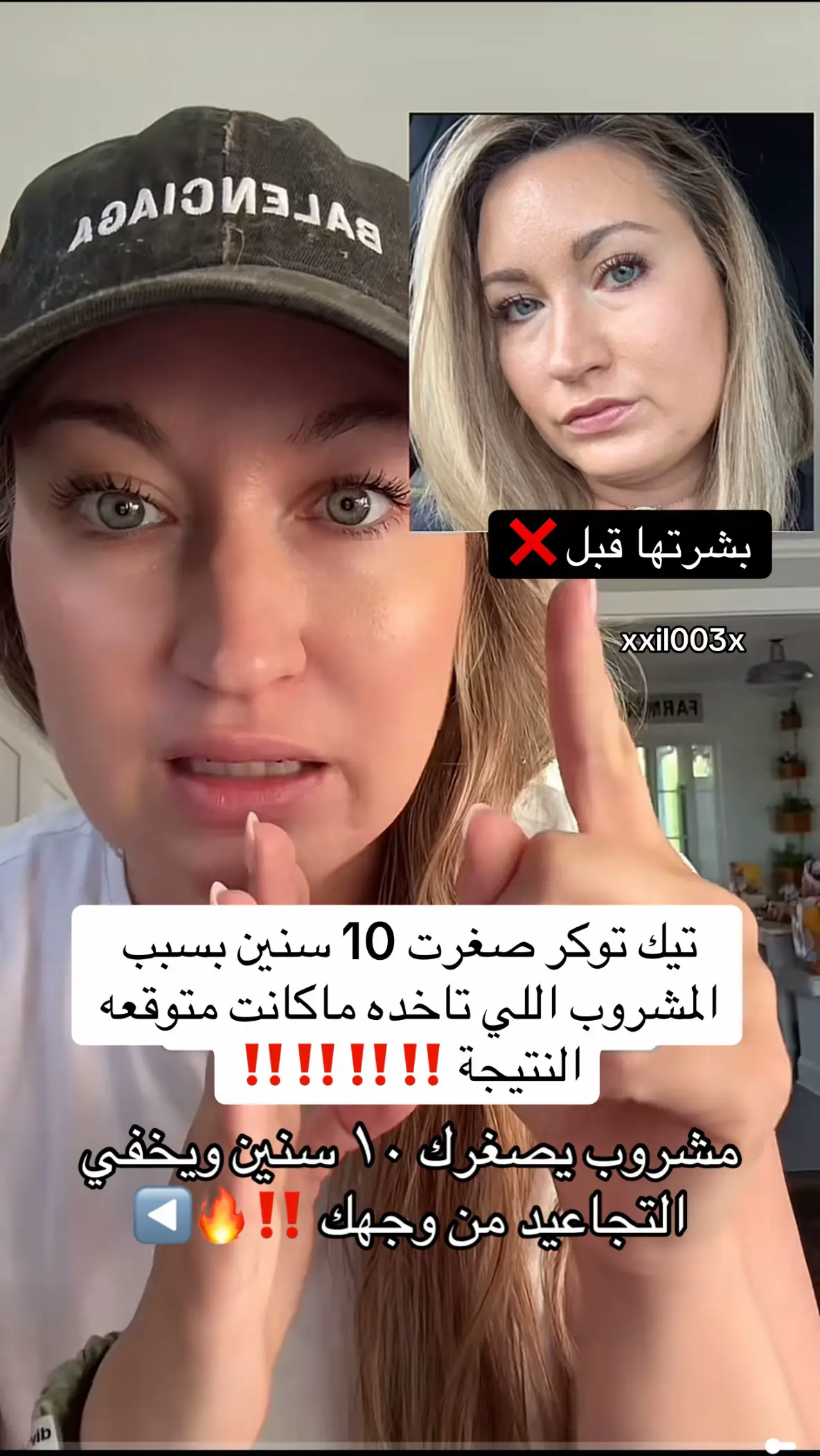 #collagen #collagensupplement #collagenviral #beforeandafterskin #skincare #glassskin #perfectilcollagen #skinhealth #beautyhacks #zoyava #iherb #كولاجين #كولاجين_طبيعي #كولاجين_طبيعي_للبشره #شراب_كولاجين #نضارة_البشرة #شد_البشرة #بشرة_صحية #بشرة_نضرة #فيتامينات #كولاجين_بحري #خطوط_تعبيرية #فوائد_الكولاجين #collagenglow #collagendrink #hairskinnails #collagenviral #تجربتي_مع_الكولاجين #بشرة_توك 