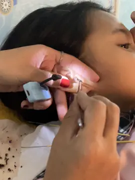 @ហាង សំអាតត្រចៀក 081 674455 