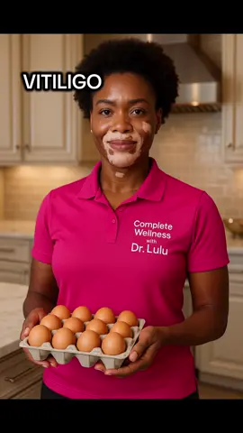 #vitiligo #DIY #healing #Drlulu 