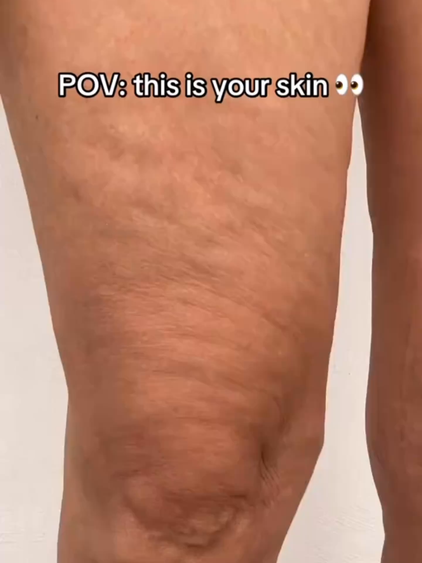 When life gives you cellulite… You ROLL it away 😏✨ This tool is addictive and your legs will thank you later 💅 🎯 Zero pain 🎯 Full glam 🎯 Portable & powerful https://liviosmart.com/products/leg-roller-massager-your-all-in-one-tool-for-toned-legs-total-wellness #ByeCellulite #MassageTime #TikTokMadeMeBuyIt #GlowUpChallenge #RollRollRoll