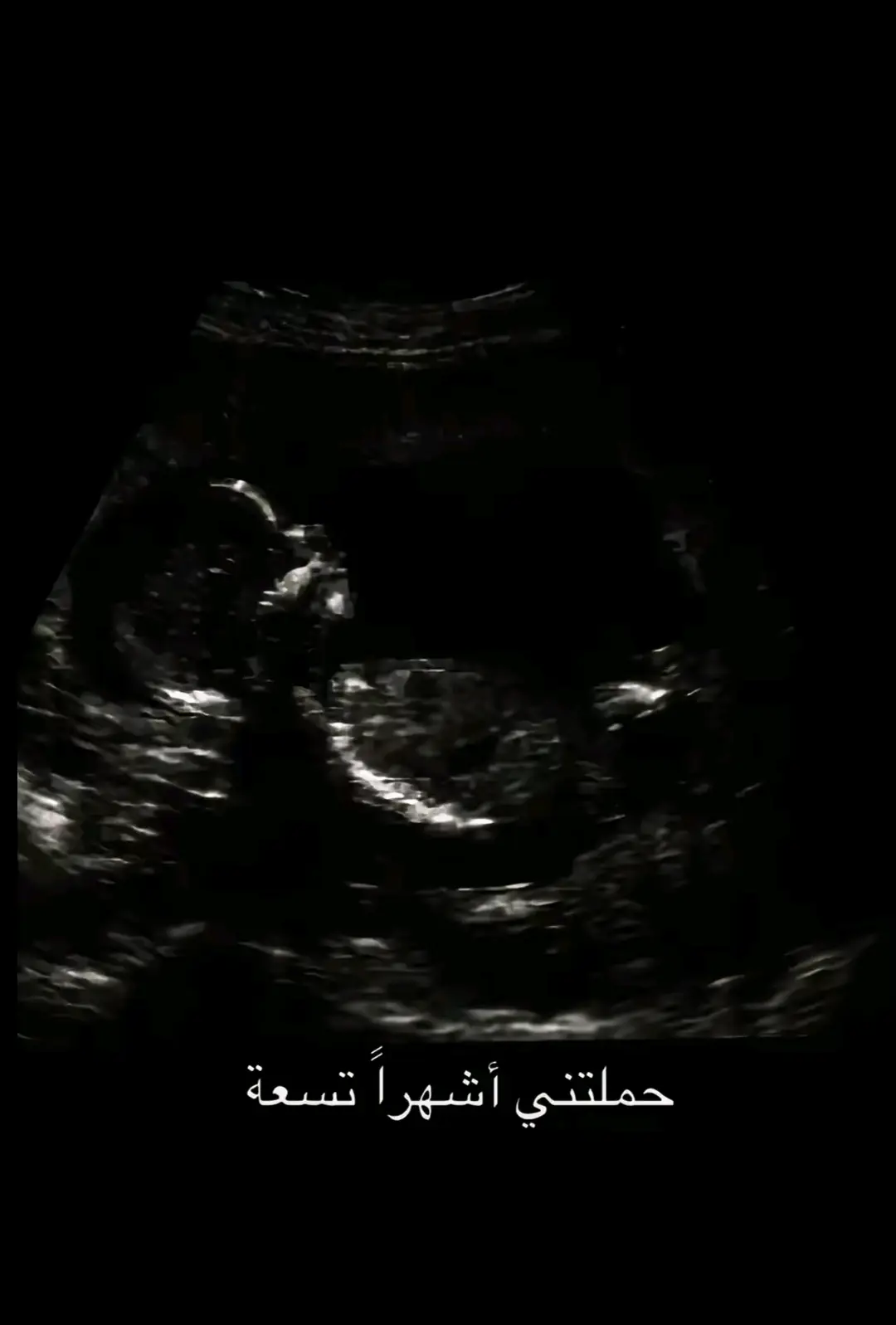 #مشايه_الأربعين #مشاية_الامام_الحسين #مشايه_للحسين_نتعنه🥺💔🥀 #like #لايك__explore___ #viral #fyp #foryoupage 