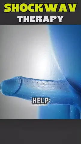 Enlarged Prostate Gland Treatment (3D Animation) #enlargedprostate  #prostateproblems  #prostateproblems  #prostateenlargement  #treatmentofenlargedprostate  #enlargedprostategland  #medical3danimation  #3dmedicalanimation 