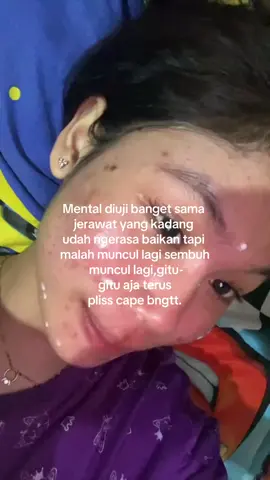udah dititik muak sama jerawat🙂#fypage #acnefighter #acne #jerawat #jerawatan 