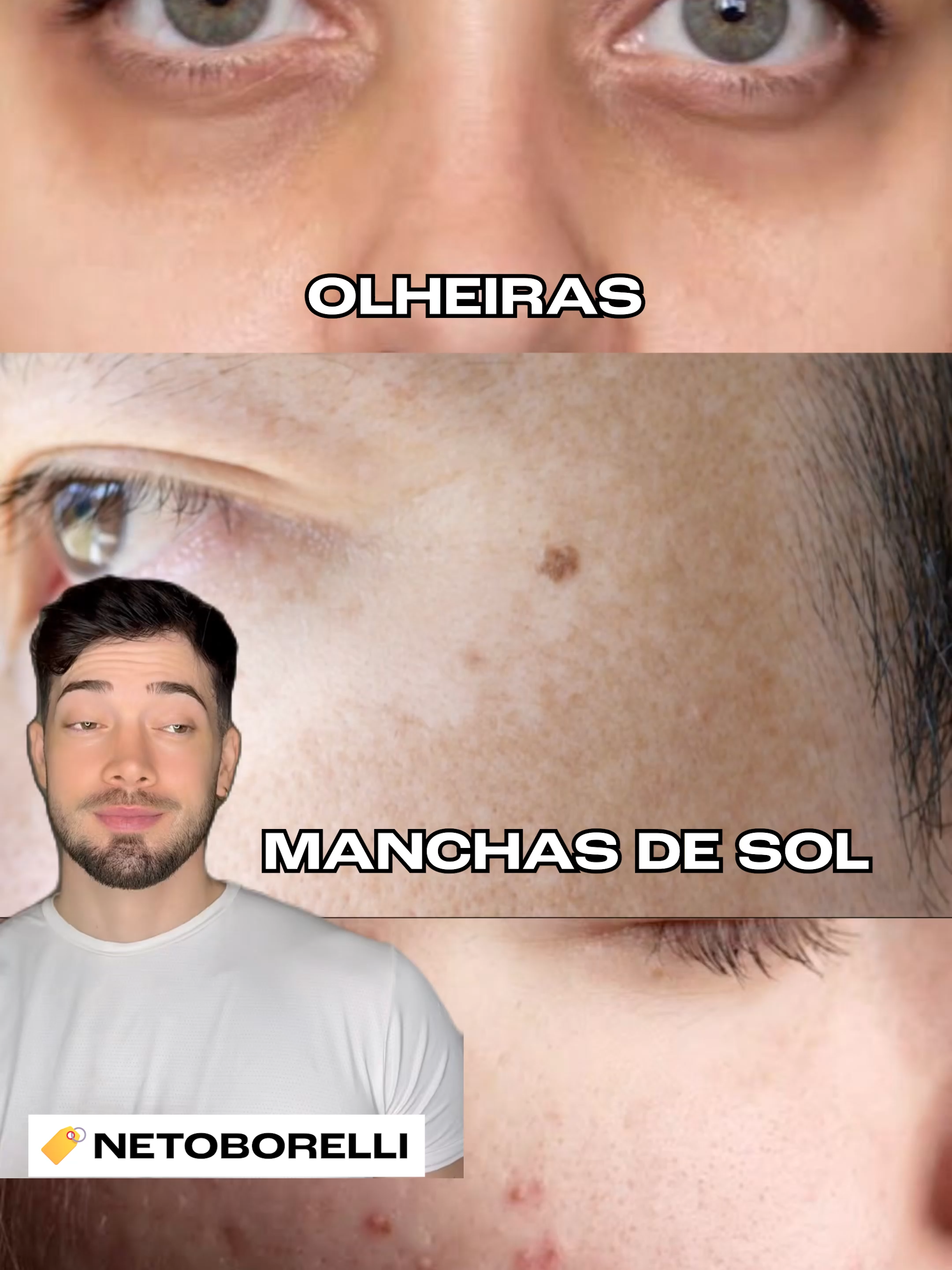 Não sabe qual o melhor Creamy para as suas queixas? Nós te ajudamos de forma bem simples. Confira!