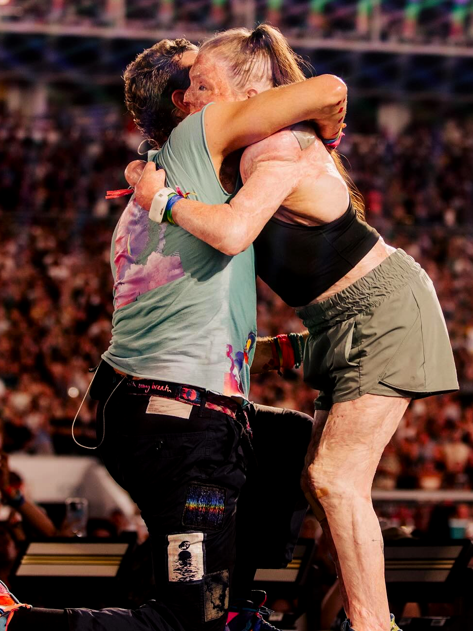 Coldplay cumplió el sueño de Jenna, una fan que sobrevivió a fuertes quemaduras y se ha sometido a más de 90 cirugías. Jenna le escribió una carta a la banda pidiéndoles que toquen 