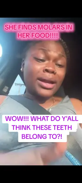#food #Foodie OMG!!! I WOULD FREAK OUT TOO!!! What do y'all think these teeth belong to?! 