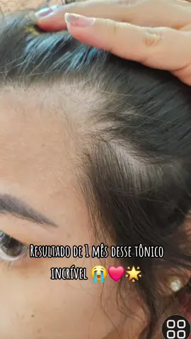 #CapCut #tonicocapilar #cabelo #hair 