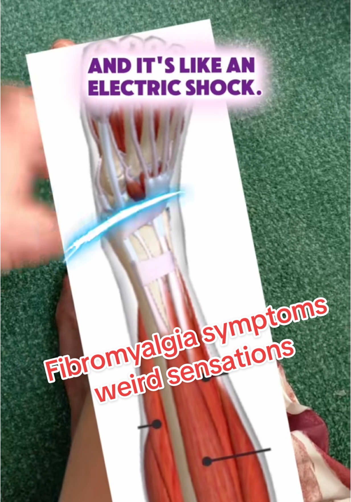 #onthisday #fibromyalgiaexplained #fibromyalgiasymptoms #weirdsensations #invisibleillness #anklepain #chronicpainlife #chronicpainawareness #electricshocks 