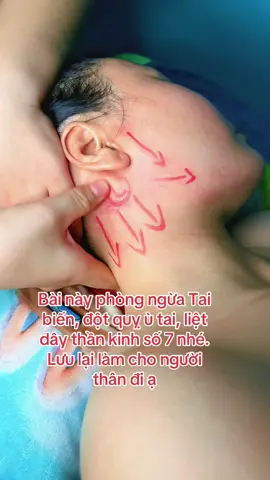 Làm thao tác này mỗi ngày phòng ngừa tai biến đột quỵ liệt dây tk số 7 nhé#xuhuong #massa #vinhloca #binhchanh #moccat #taibien #dotquy 