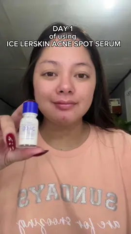 I only used Ice Lerskin Acne Serum for 3 days and I already see a big difference! Super effective on my skin — kalma agad ang pimples and redness. 💙✨ #RealResults #IceLerskinGlow