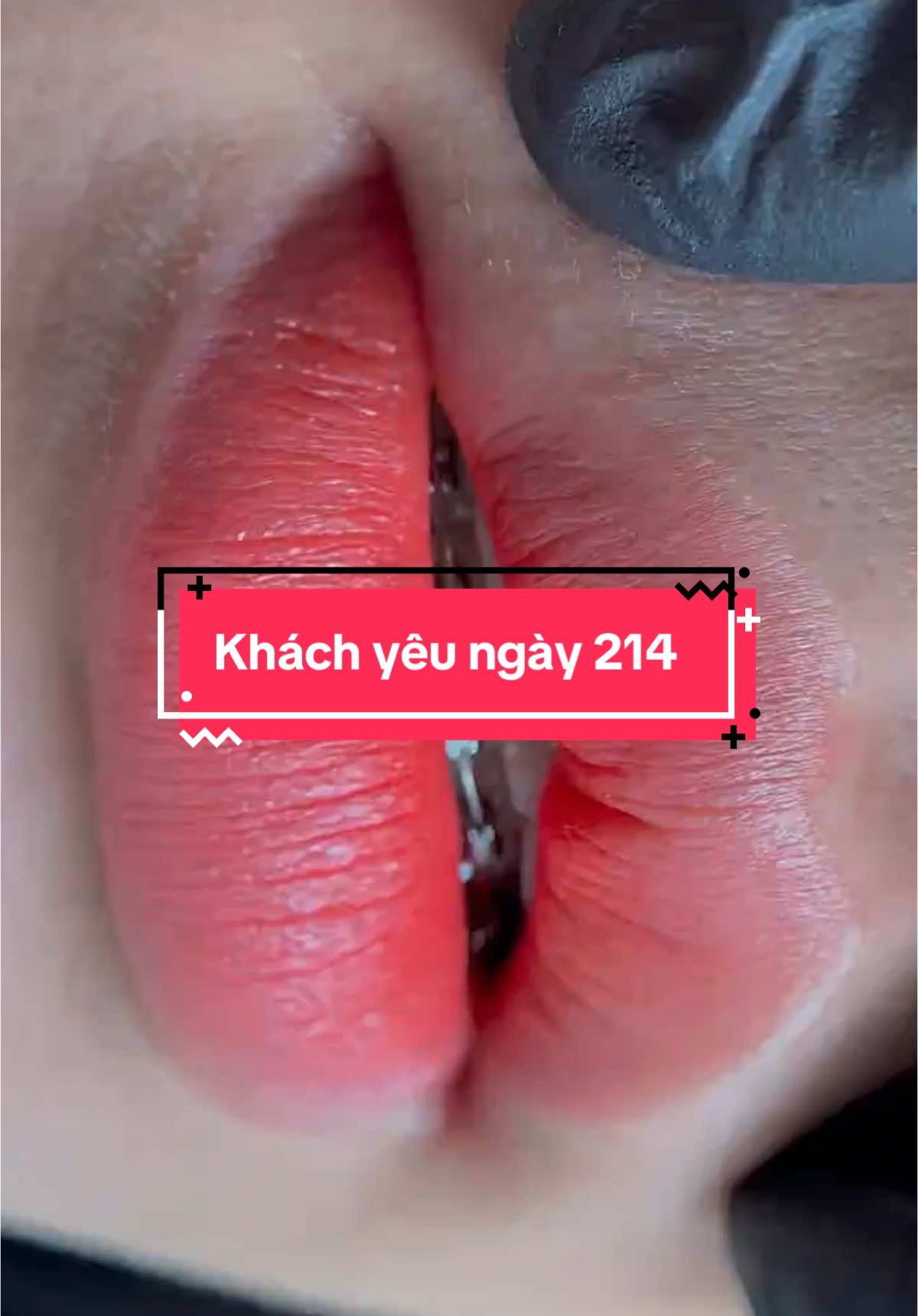 💋 MÔI THÂM KHÓ TRÁNH – NHƯNG GIẢI QUYẾT THÌ DỄ 💥 Chỉ sau 1 lần khử thâm tại Kim Beauty, môi chị em hồng hào, căng mịn như cánh hoa đào 🌸 #Khuthammoi #khuthammoinam #khongsungdau #MoihongtuNhien #kimbeauty 