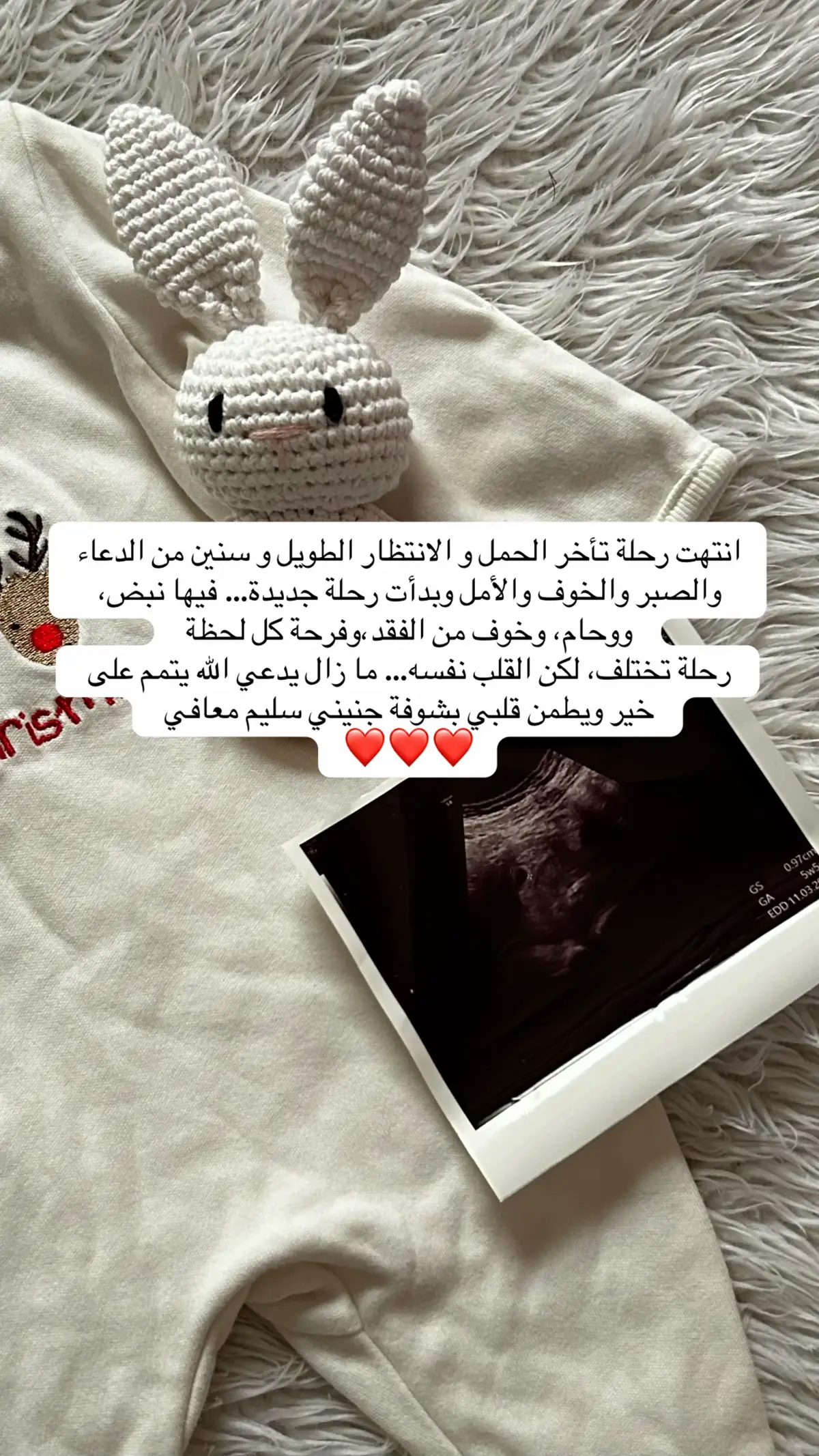 #اكسبلورexplore #الحقن_المجهرى #تكيسات_المبيض #ترندات_تيك_توك #هاشتاقات_تيك_توك_العرب #ربي_لاتذرني_فردا_وانت_خير_الوارثين #السعودية #تأخر_الحمل #جبرالخواطر #حمل #تجارب #جنيني💙 #نبض_قلبي🖇❤️ #امل #تفاؤل 