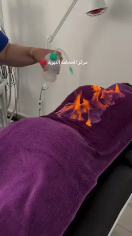 الفوطة النارية لعلاج البرد وجميع مشاكل الظهر ❤️ #العلاج_بالقرآن #الصحة #الطب #الحجامة #علاج_بالاعشاب #الفوطة_النارية #مساج_علاجي 