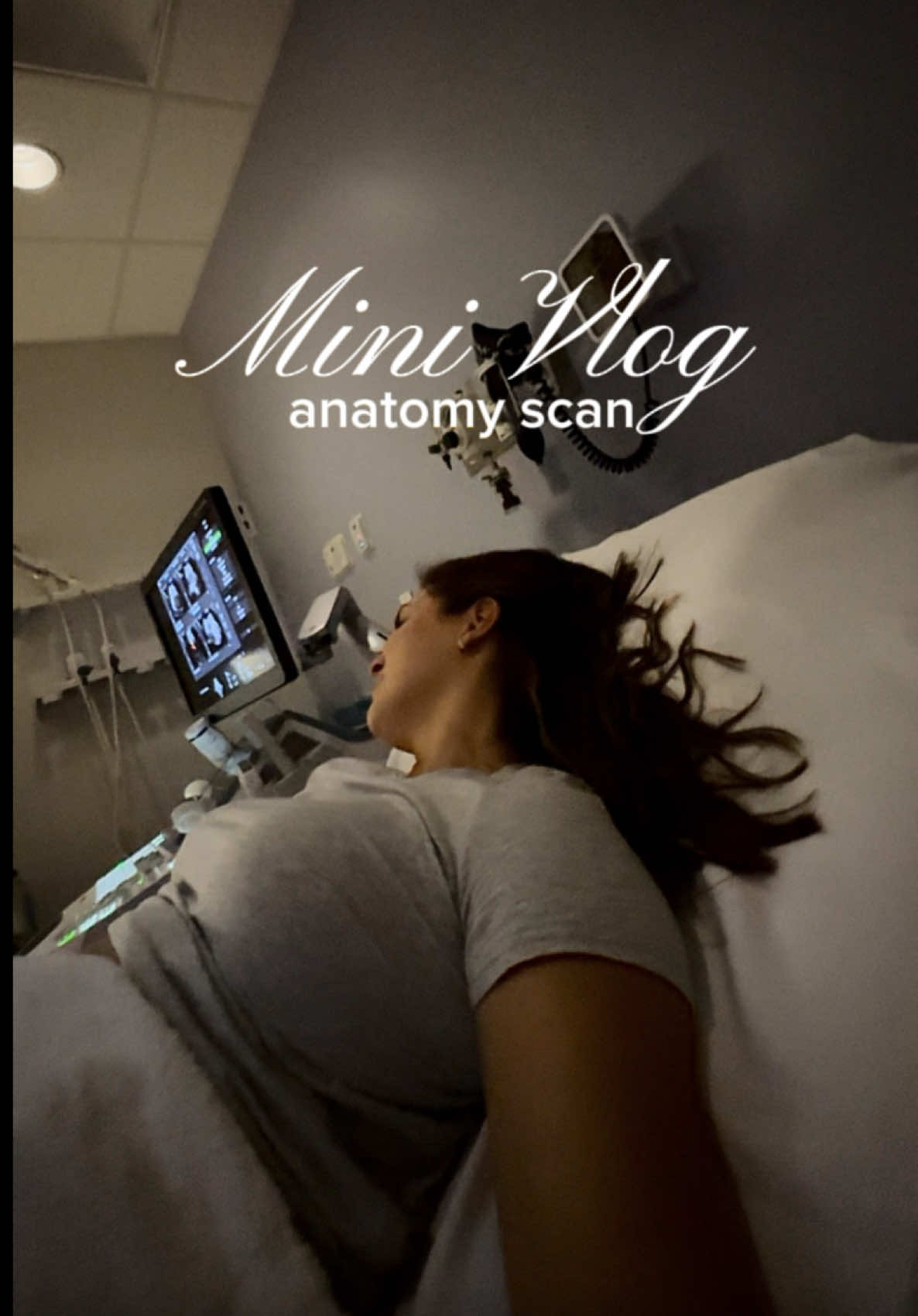 Got to see his face in 3D today 🥹 anatomy scan day + the sweetest little surprise 🩵 so thankful I get to document this season. #babyappointment #anatomyscan #pregnancytiktok #pregnancyjourney #CapCut 