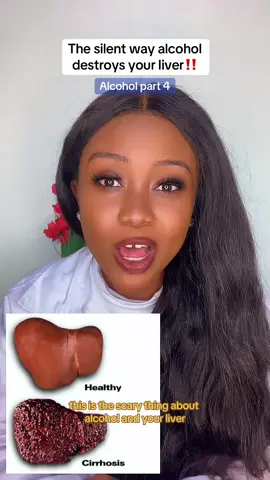 Alcohol destroys your liver in a very silent way,by the time you notice the signs like yellow eyes and swollen stomach it will be too late.Drink wisely ‼️ #liver #liverdisease #alcohol#healthtalk #healthyliving 