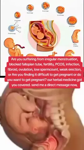 DM to order Fertility medicine to conceive and give birth to healthy babies. Are you finding it difficult to get pregnant or do you want to get pregnant? our fertility herbal medicine got you covered.  #ttccommunity #ttcjourney #infertiltiy #pregnancy #infertilityjourney #antinatal #pcosproblems #barreness #menopause #fertilitystore #miscarriageawareness #postnatal #fyp #viral #tiktokviral #tiktoknigeria #tiktokusa #tiktokfrance #pcos #infertilitytreatment #testtubebaby #ivfclinicdelhi #fertility #infertility #ttc #ivf #baby #pregnancy #health #child #fertility #viral#shivamivfcentredelhi #shivamivfclinic #fyp #iui  #ivfcommunity #infertilitvawarenesccomodation #canada #trend #shivamivf #fibroids #conceive #tryingtoconceive #short #time #canada_life #ourfamilyourjourney #trancetiktok #italy #uklife #usa #kuwait #kuwait #england #america #london #ireland #florida #california #mexico #texas #pregnantstyle #pregnantyoga #pregnancydiet #pregnancydiary #Love #life #pregnancyfashion #parentingtips #momlife #dadlife 