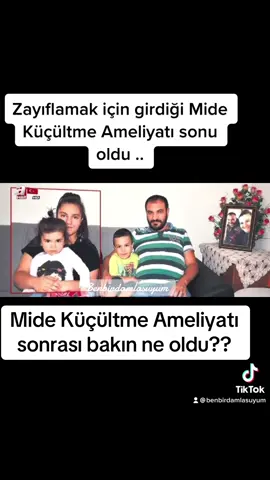 ##almanyadakitürkler #almanyada #almanya🇩🇪 #yurtdışındakitürkler #benbirdamlasuyum #midebotoksu #türkiyem 