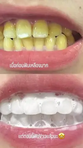 🤩#ใช้ดีบอกต่อ #ยาสีฟัน #ยาสีฟันขิงขิง 