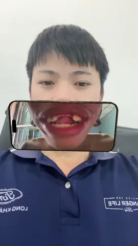 Hát xong bài hát của thái mà rụng mịa 2 cái răng 🤣🤣