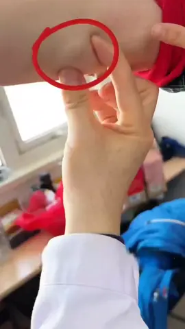 rekomendasi lipoma cream salep benjolan #lipoma #lipomacream #salepbenjolan 