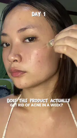 nindot jud kaau ni pramis!😭💗 #jmcyxteashell #teashellacneserum 