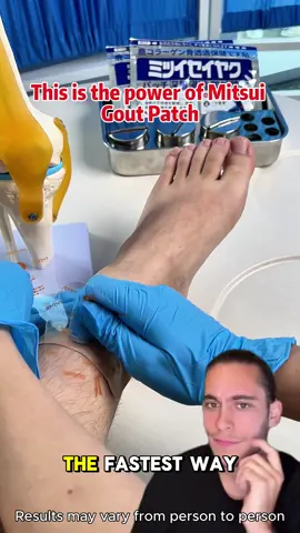 Struggling with joint pain? Try this gout patch — just stick it on and feel the relief!#GoutPatch #GoutRelief #JointCare #HealthyLiving #gout #goutpatch #patch #ZL