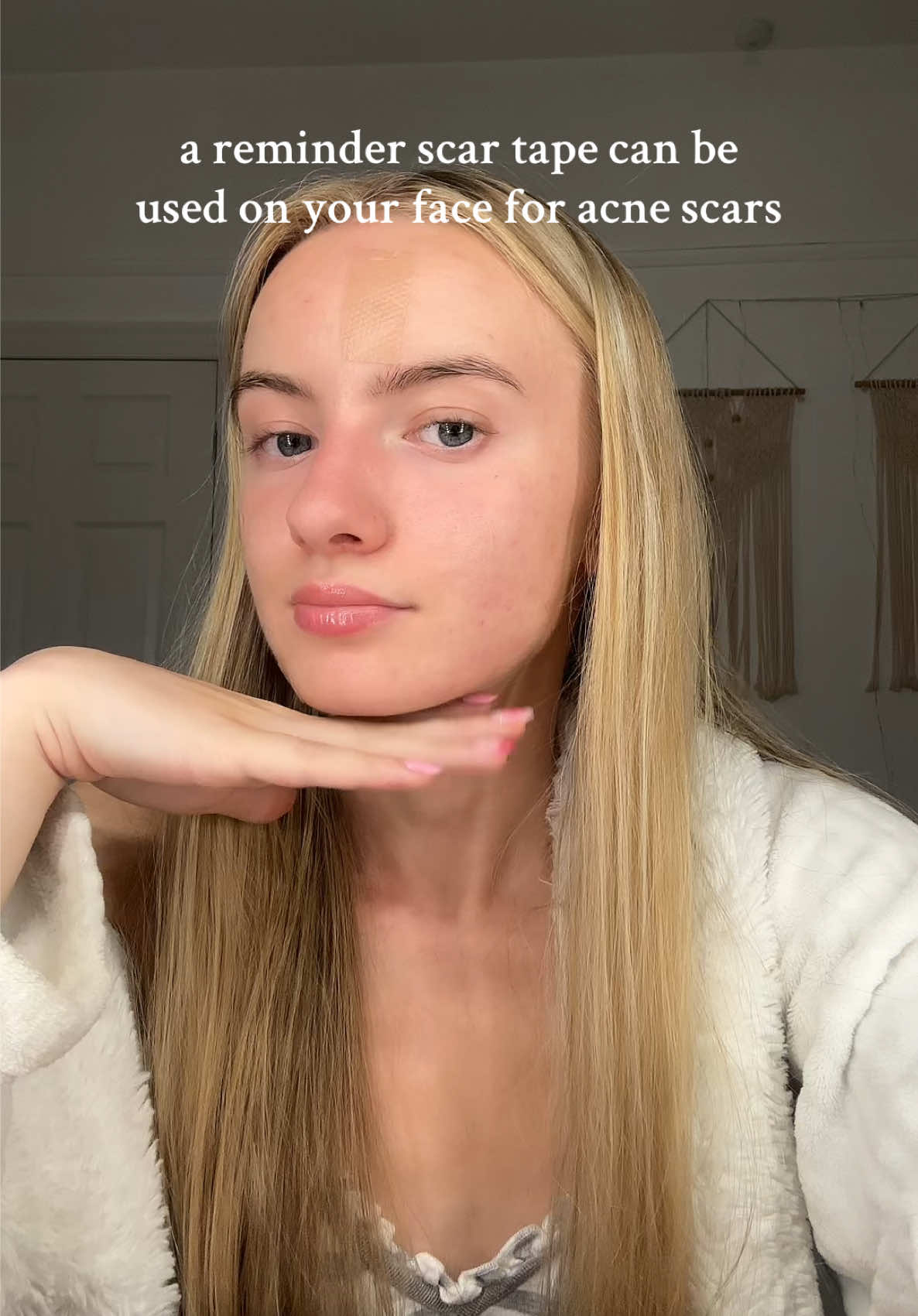 i know it’s scar tape for a reason but it’s usually used elsewhere around the body   #fyp #acnescars #acne #smoothskin #smilelines #frownies #wrinkles #scartape #scarsheets #scars 