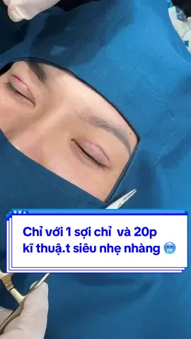 Chỉ với 1 sợi chỉ  và 20p  kĩ thuậ.t siêu nhẹ nhàng 🥶#Tuyết_Diamond #videoviralitiktok #xuhuong #Mí_form_tự_nhiên #Mí_đẹp #nhấn_Mí_tự_nhiên