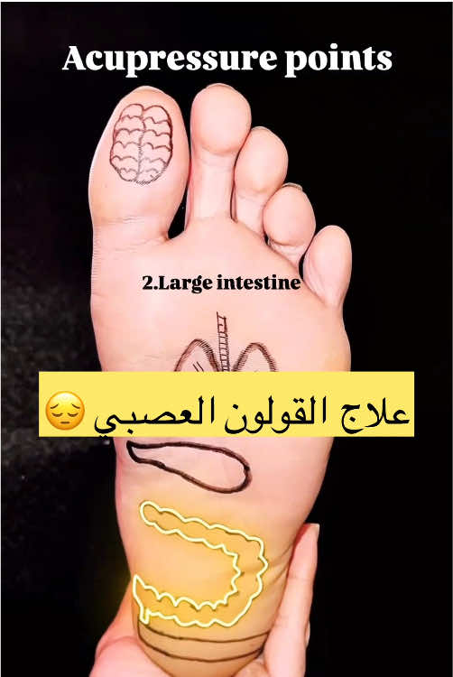 نقطة علاج بالضغط على القدم لعلاج القولون العصبي و ألم المعدة acupressure point in foot for irritable bowel and stomach pain relief #نقطة #ضغط #acupressure #acupressurepoints #acupressuretherapy #stomachproblems #قولون_عصبي 