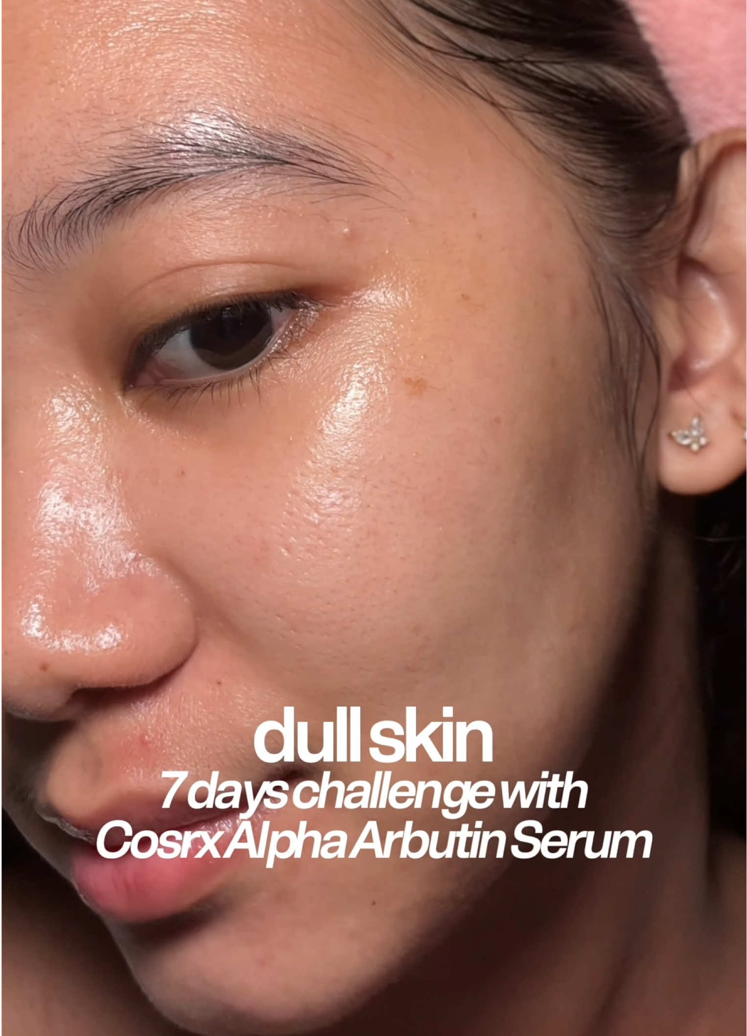 my 7 day dull skin journey with @COSRX Official Alpha Arbutin Discoloration Care Serum ✨  @cosrx.ph  #cosrx #cosrxdermskincare #AlphaArbutin #AlphaBrightening #hyperpigmentation ##darkspots #skincare #beautyskincare #kbeauty #fyp #foryoupage 