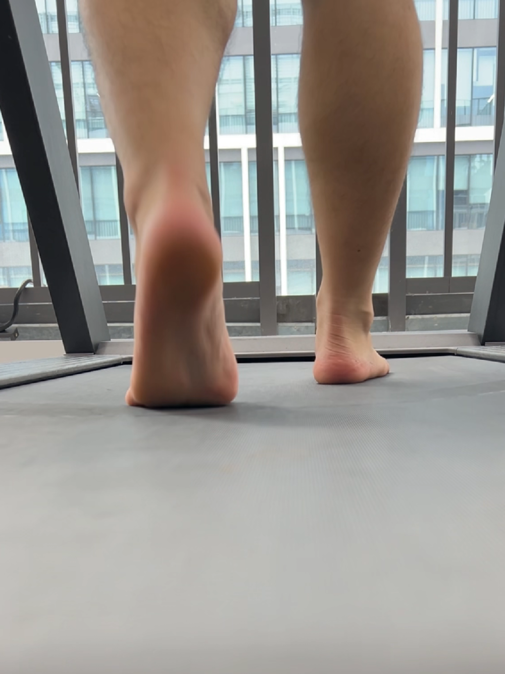 If you feet hurt after walking for a while,it may be a problem with plantar fasciitis!#archsupport #plantarfasciitisrelief #footalignment #orthotics #flatfeet #footpainrelief #heelpain 