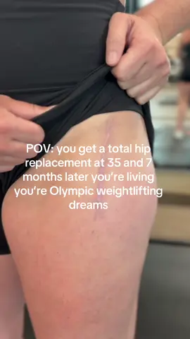 35 and a total hip replacement.  #totalhipreplacement #totalhipreplacementrecovery #younghipreplacement #girlswholift #olylifting 