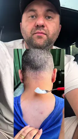 Що зробить сода з твоїм тілом. 