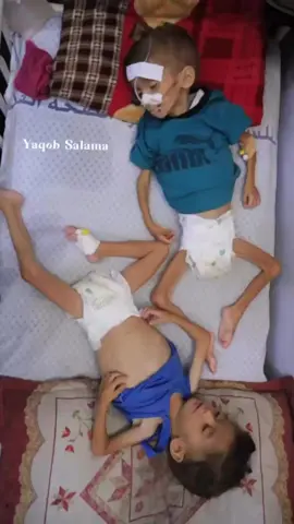 #palestine #currently #gaza #savethem #children #shameontheworld #raisingawareness #🇵🇸 #starvation #malnutrition #israhell #openyoureyes #iamashamed #help #foryou #pourtoi @Keir Stamer  @Emmanuel Macron 