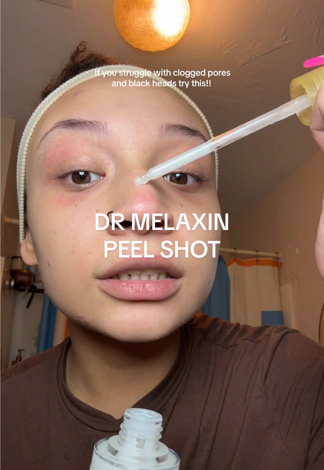 if you have clogged pores and black heads and want to get rid of them + have baby soft skin you need to try this!! 🙏🏼🤍 #drmelaxin #peelshot 