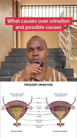 #urination #overreactive 