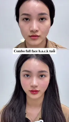 #filler #botox #trending 