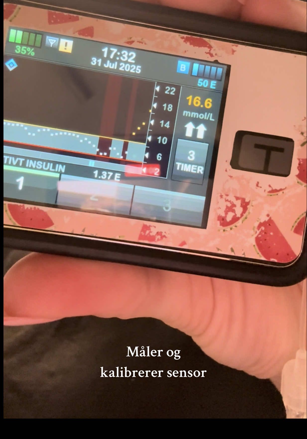 Diabetesutstyret har ikke vært det beste de siste dagene… #fyp #t1dlookslikeme #typeonediabetes #t1d #dexcom #dexcomg7 #tandemtslimx2 #viral #trending 