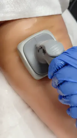 Targeting Thigh Fat & Cellulite Reduction (Back of Thighs) As a certified medical aesthetician, I offer customized body treatments to help reduce stubborn fat and minimize the appearance of cellulite on the back of the thighs.#skincare #afghanistan🇦🇫 #fly #toronto #SmoothSkin #skin #skin #fly #treatment #cellulite #fat #fatreduction #skincare 
