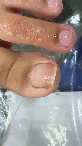 🤤| ASSISTA A ESSE MEGA PEELING SATISFATÓRIO .  #satisfatório #podologia #nails #peeling #satisfying