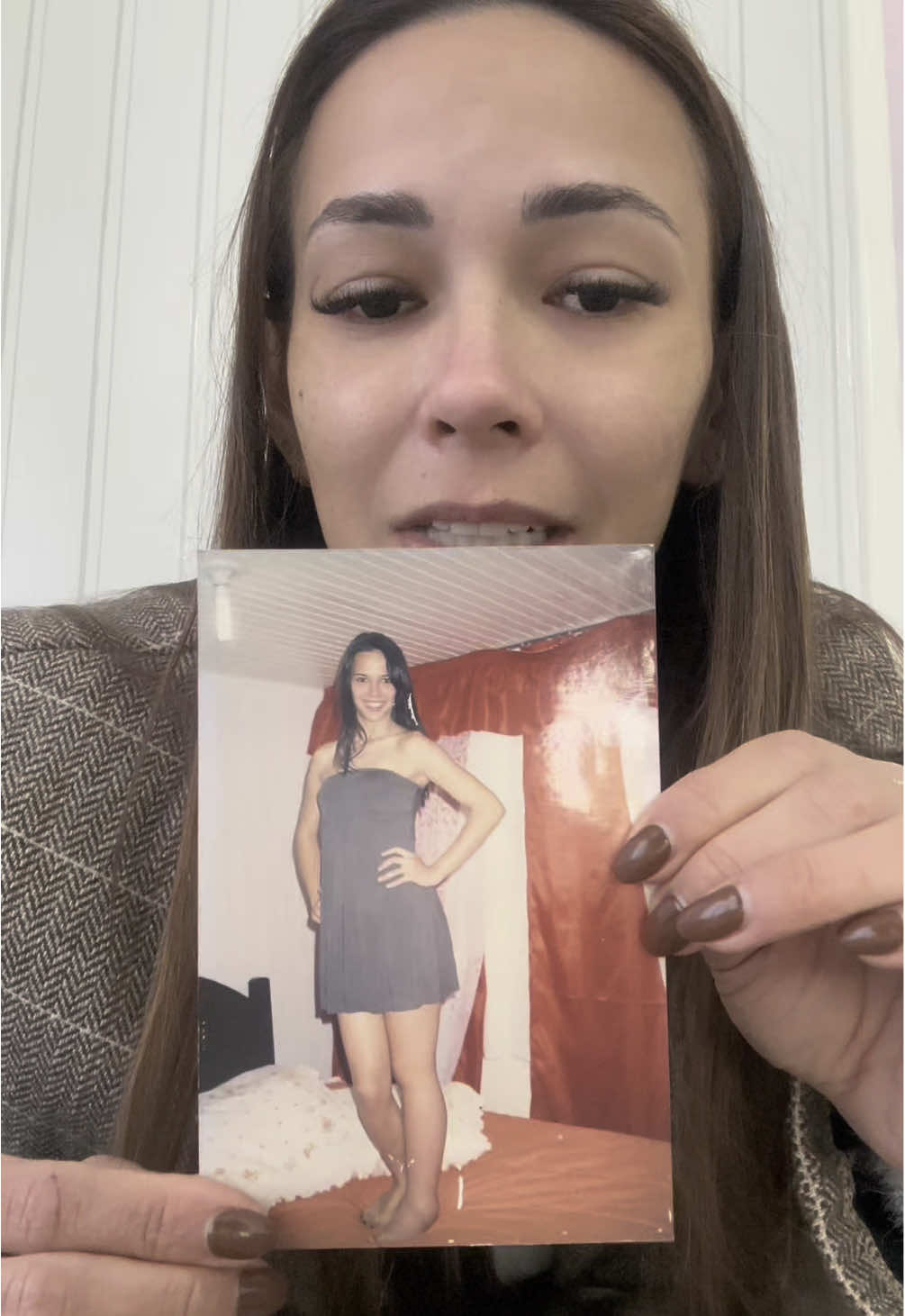 Minhas fotos mostram o início do linfedema …isso é real infelizmente como queria que não fosse, como desejei deitar a noite e acordar no outro dia não tendo mais nada na minha perna, tive que are der a conviver …. Mas só me aceitei no início desse ano de 2025 e me vi ! Caí em si de que sou linda mesmo com uma perna mais grossa que a outra, e que mudar e melhorar esse quadro só dependia de mim…#linfedetemtratamento #linfedemaprimario #autoaceitacao