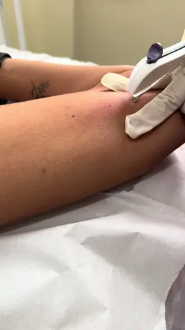 Você merece viver leve, segura e no controle da sua saúde. No consultório HumanNurse, a inserção do Implanon vai muito além de um procedimento. Aqui, você é acolhida, ouvida e acompanhada por quem entende profundamente da saúde da mulher. 🔸 Procedimento seguro, rápido e praticamente indolor 🔸 Equipe especializada e referência em inserção de Implanon 🔸 Acompanhamento humanizado antes, durante e depois 🔸 Inúmeras mulheres confiando no nosso cuidado Pare de sofrer com anticoncepcionais que não funcionam pra você. Escolha um método moderno, eficaz e com até 3 anos de proteção. Agende agora sua avaliação e venha viver essa experiência com a gente. 👩‍⚕️ HumanNurse — referência em saúde da mulher com olhar humano. #Implanon #ImplanonBrasil #ImplanonHumanNurse #MétodoContraceptivo #SaúdeDaMulher #EnfermagemGinecológica #ImplanonComCuidado #HumanizaçãoNaSaúde #GinecologiaHumanizada #EmpoderamentoFeminino #ConsultórioHumanNurse #VidaSemPreocupação #CicloMenstrual #enfermeira #mulheresquecuidam 