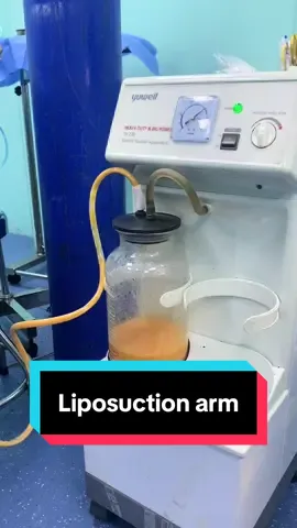 remove excess arm fat in 30 minutes. #Dr_lee #liposuction #vientiane #laos🇱🇦 