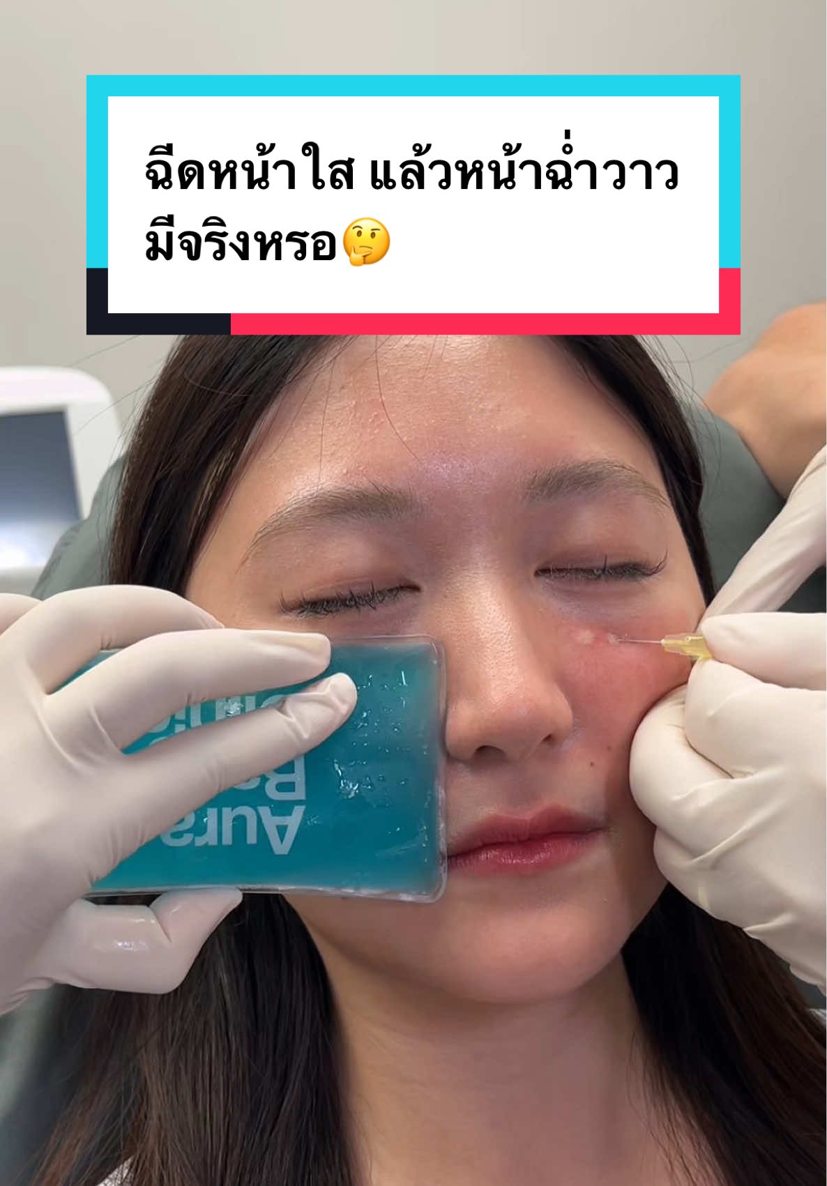 ฉีดหน้าใส แล้วหน้าฉ่ำวาว มีจริงหรอ🤔 #AuraXpress #ฉีดหน้าใส #รีวิวฉีดหน้าใส #ฉีดหน้า #หน้าใส #หน้าเงา #หน้าวาว #หน้าเงากระจก #สิวหาย #หน้ากระจ่างใส #หน้า 